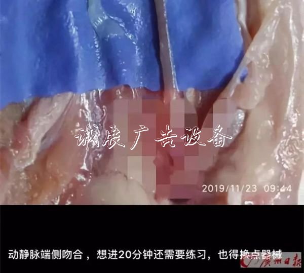 他每天都來買雞鴨翅，滾動燈箱但只買一個！真相讓網(wǎng)友